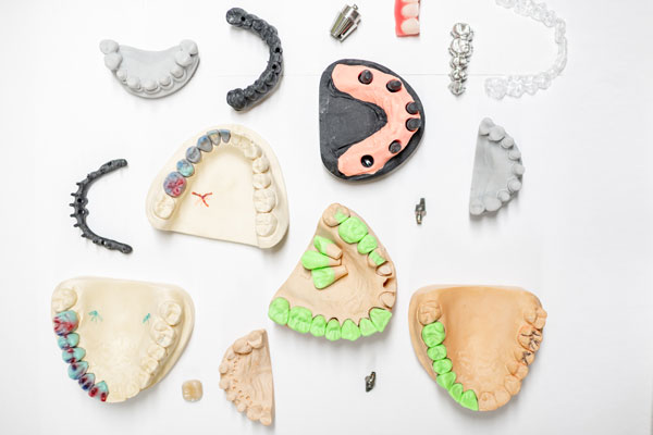 Artificial Jaw Models With Dental Implants 2025 03 14 18 35 20 Utc Web